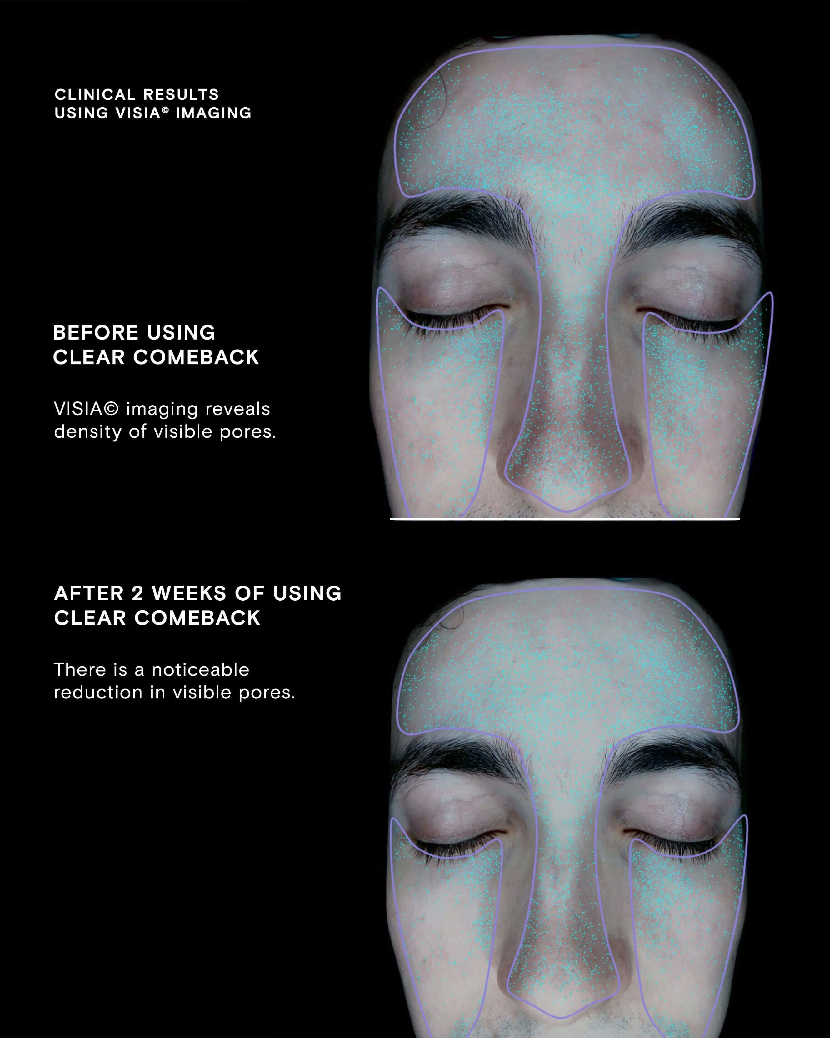 Clear Comeback Probiotic Enzyme Power Serum
