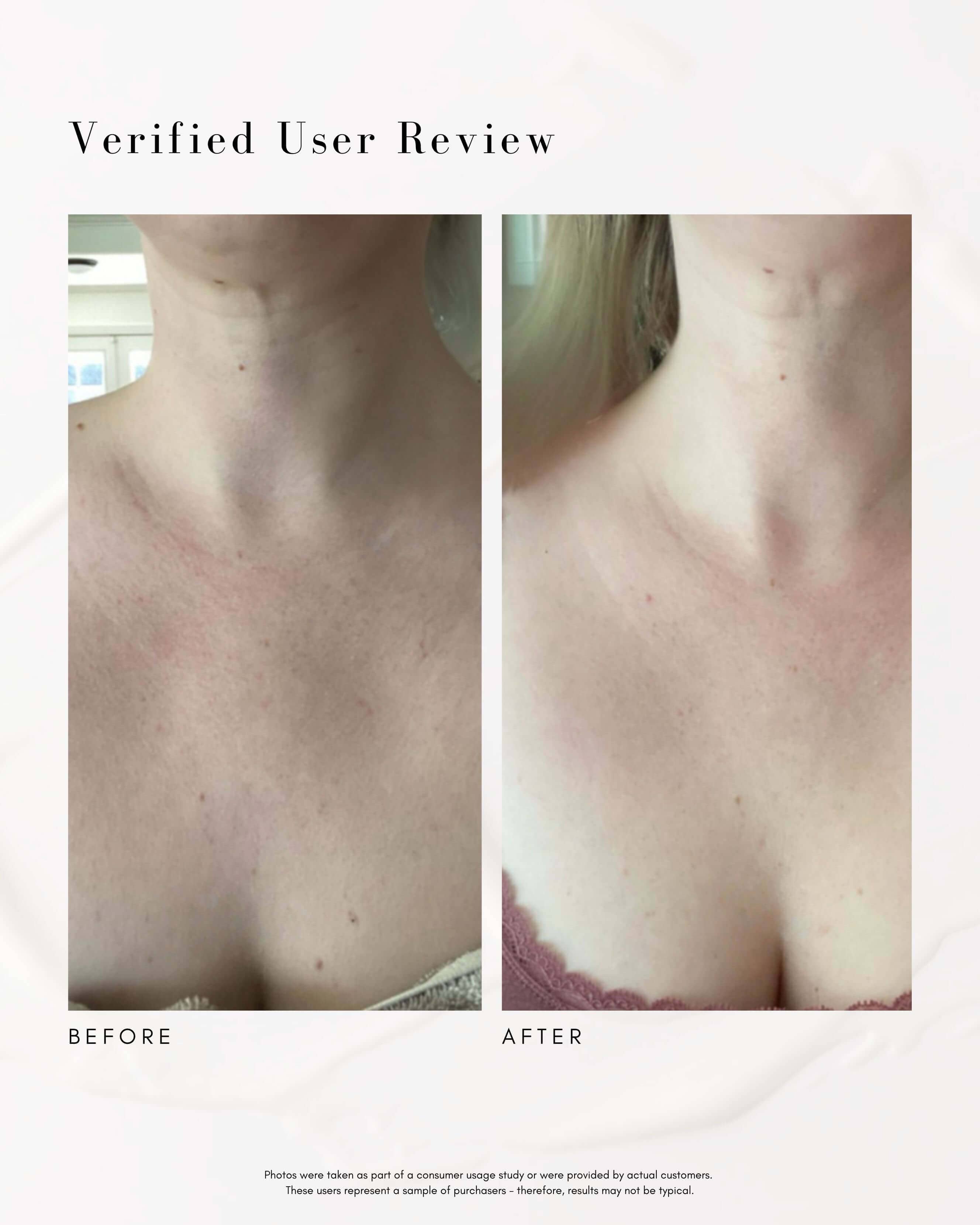 The Advanced Response Complex Face | Neck Cream