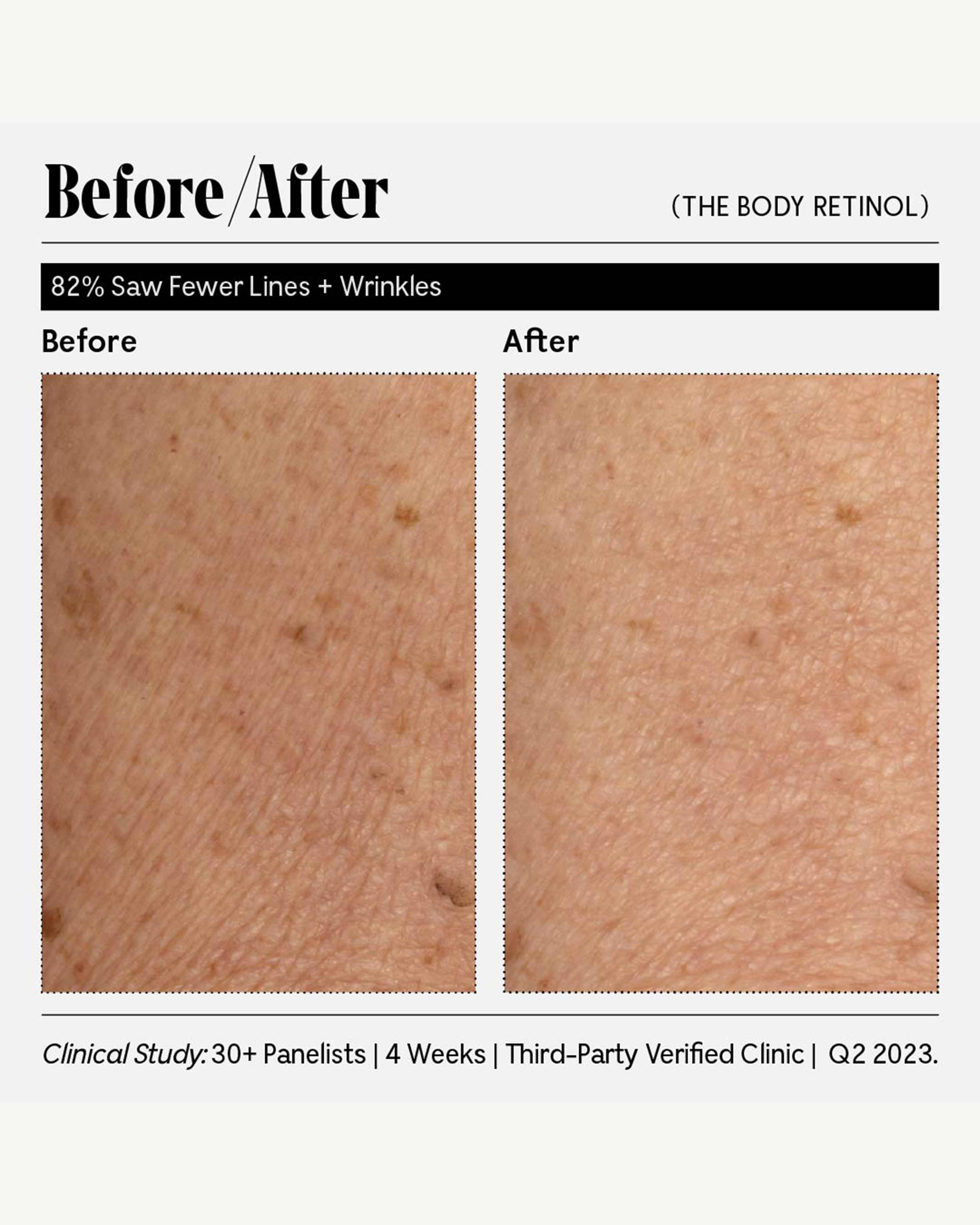 The Body Retinol