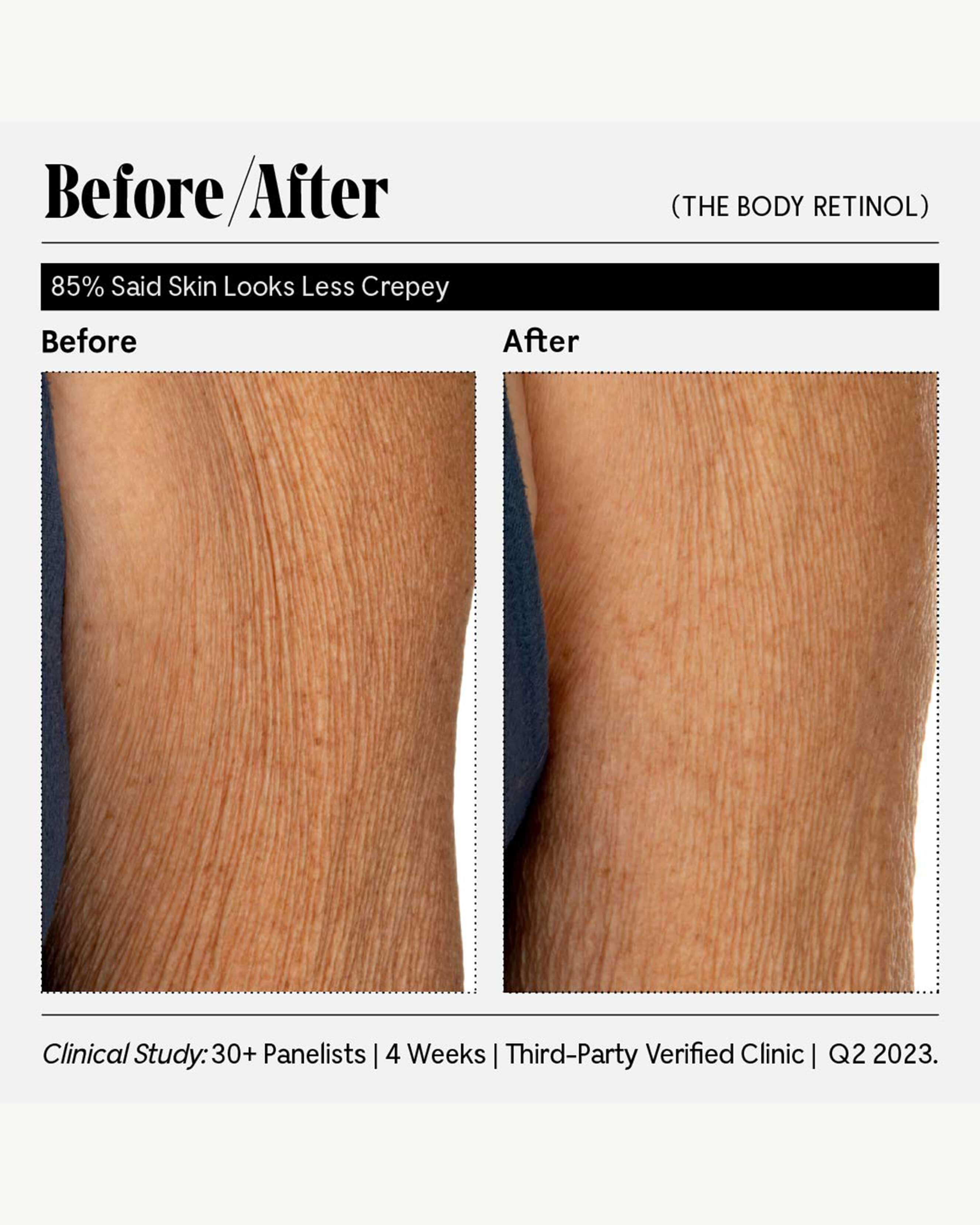 The Body Retinol