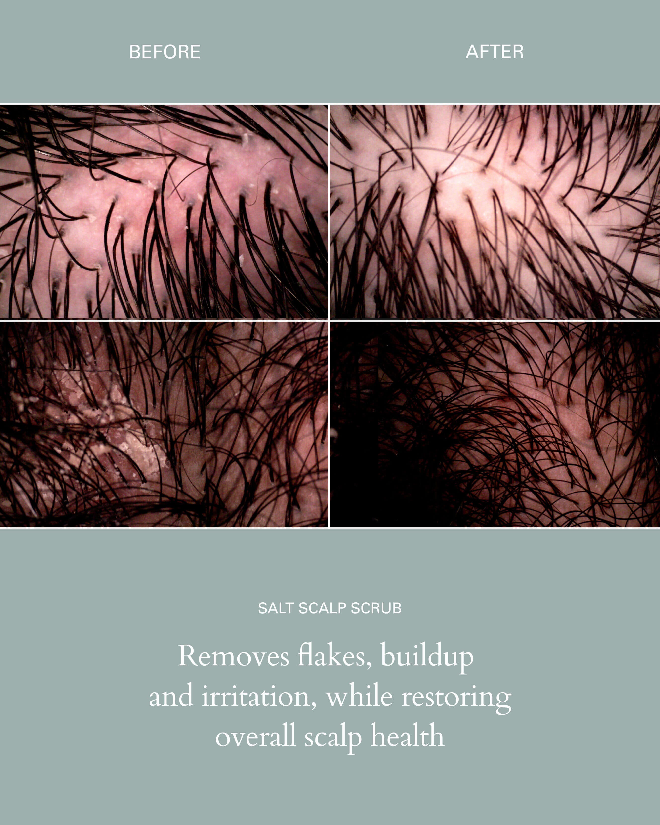 Salt Scalp Scrub