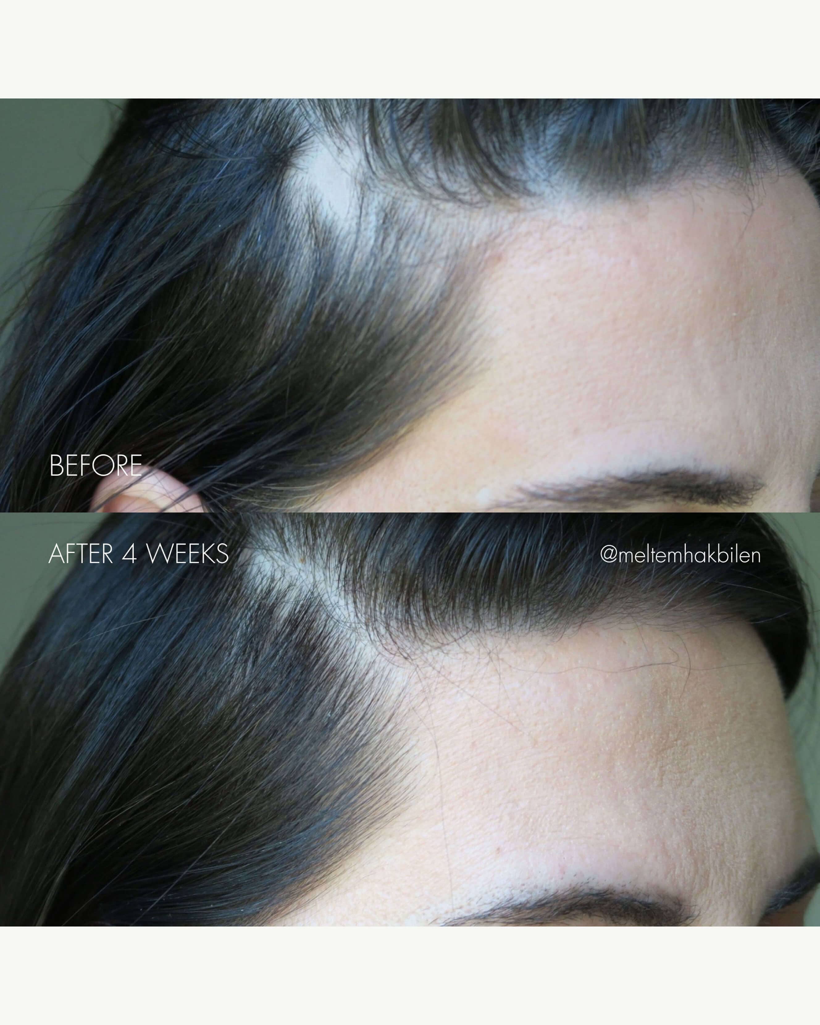 The Hair Serum